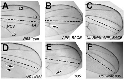 Association of the Protein-Quality-Control Protein Ubiquilin-1 With Alzheimer’s Disease Both in vitro and in vivo